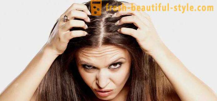 Preto rýchlo zhirneyut vlasy? Možné dôvody, vlastnosti a spôsoby liečenia