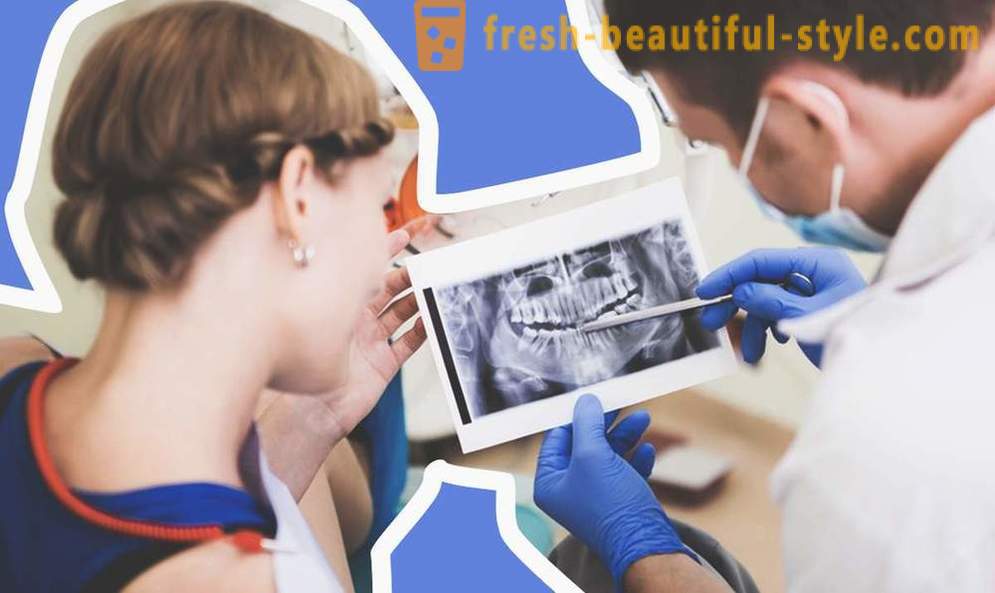 4 otázky o zubných implantátov