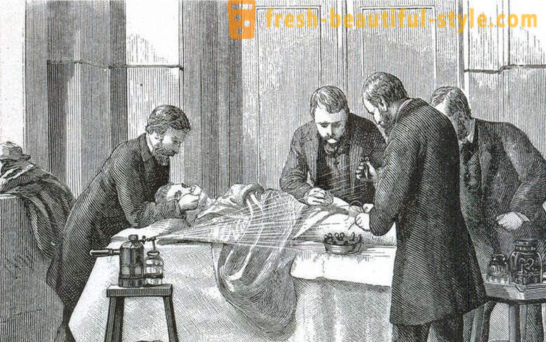 Šokujúce fakty o viktoriánskej operácii